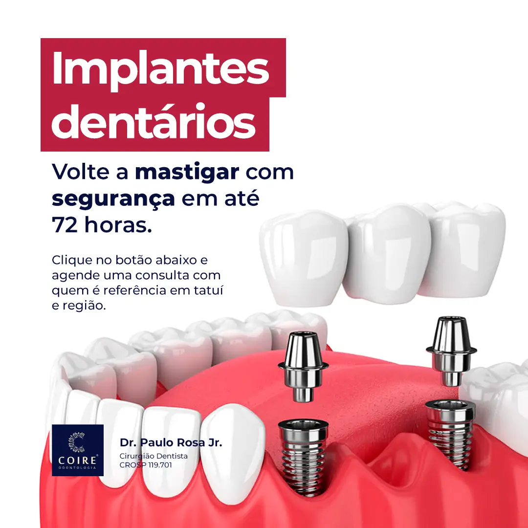 Dr. Paulo Rosa dental implants ad