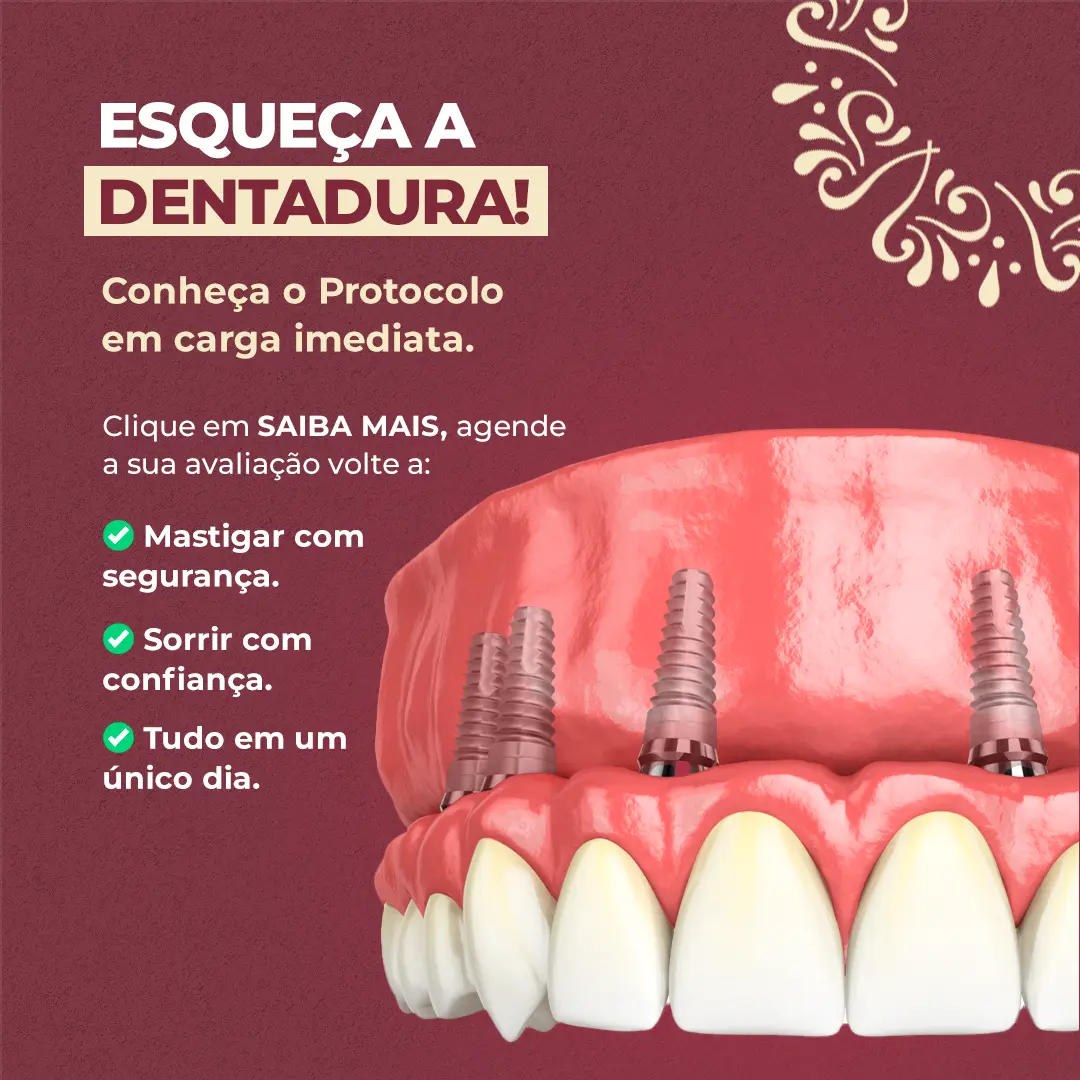 Coire Odontologia full-arch implant ad